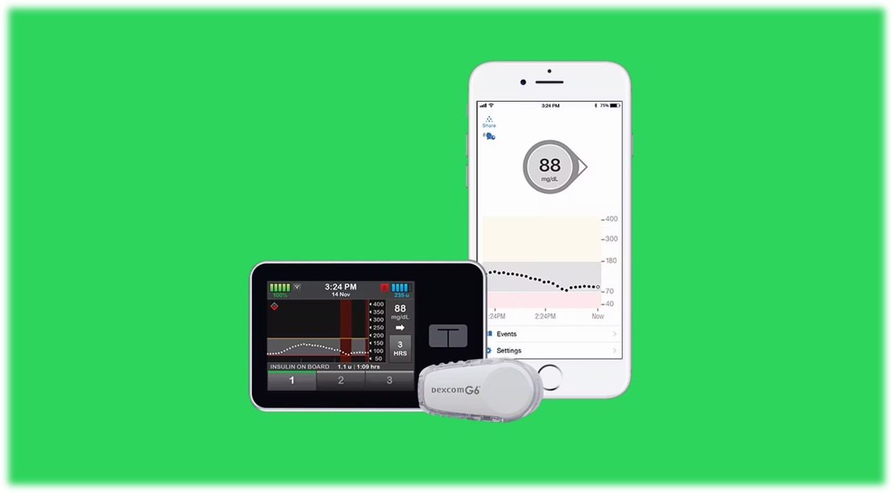 Dexcom 3